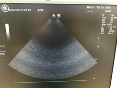Ultrasound system(Color)｜LOGIQ 7｜GE Healthcare photo22