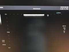 Ultrasound System(Color)｜SSA-790A Aplio XG｜Canon Medical Systems photo19