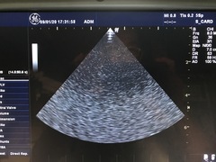 Ultrasound system(Color)｜LOGIQ P5｜GE Healthcare photo19