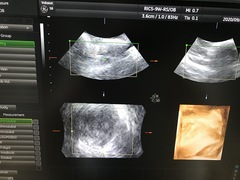 Ultrasound system(Color)｜Voluson S8｜GE Healthcare photo22