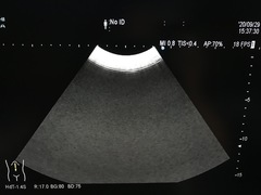 超音波診断装置の写真18枚目