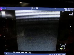 Ultrasound system(Color)｜SSD-4000SV｜Aloka photo2