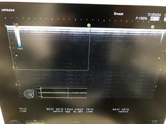 Ultrasound system(Color)｜HI VISION Avius｜Hitachi photo3