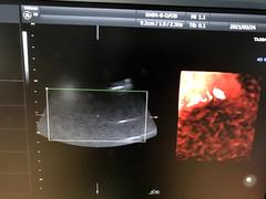 Ultrasound system(Color)｜Voluson E8｜GE Healthcare photo17