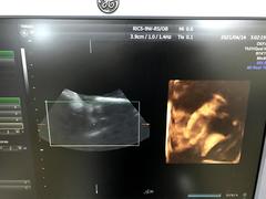 Ultrasound system(Color)｜Voluson S6｜GE Healthcare photo17