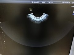 Ultrasound system(Color)｜Voluson E6｜GE Healthcare photo16