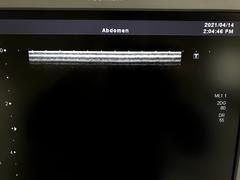 Ultrasound system(Color)｜SSA-660A Xario(LCD)｜Canon Medical Systems photo15