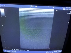 Ultrasound system(Color)｜SSD-4000｜Aloka photo2