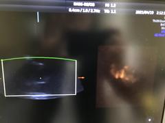 Ultrasound system(Color)｜Voluson S8｜GE Healthcare photo17