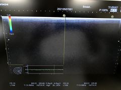 Ultrasound system(Color)｜HI VISION Avius｜Hitachi photo17