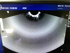 Ultrasound system(Color)｜LOGIQ iM｜GE Healthcare photo2