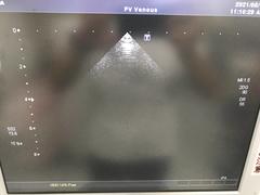 Ultrasound system(Color)｜SSA-660A Xario(LCD)｜Canon Medical Systems photo16