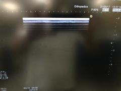Ultrasound system(Color)｜HI VISION Avius｜Hitachi photo19