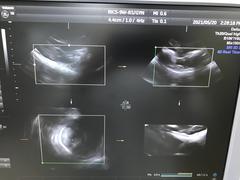 Ultrasound system(Color)｜Voluson S8｜GE Healthcare photo14