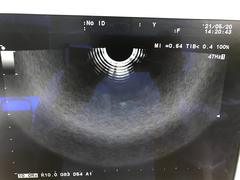 Ultrasound system(Color)｜Prosound α6｜Hitachi photo16