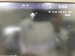Ultrasound system｜F37｜Hitachi photo19