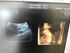 Ultrasound system(Color)｜Voluson S6｜GE Healthcare photo18