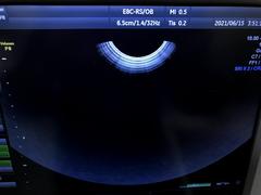 Ultrasound system(Color)｜Voluson P8｜GE Healthcare photo10