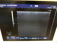 Ultrasound system(Color)｜EUB-7000HV｜Hitachi photo14