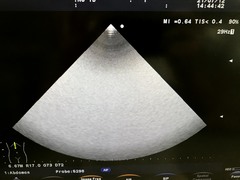 Ultrasound system｜F37｜Hitachi photo16