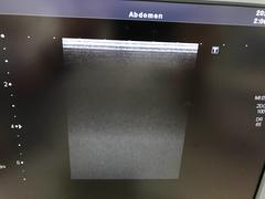 Ultrasound system(Color)｜SSA-660A Xario(LCD)｜Canon Medical Systems photo15