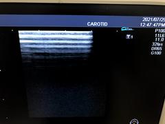 Ultrasound system(Color)｜SSA-580A Nemio XG｜Canon Medical Systems photo19