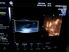 Ultrasound system(Color)｜VOLUSON 730PRO｜GE Healthcare photo22