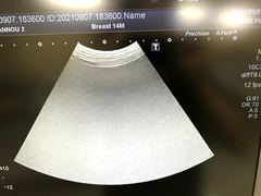｜Aplio 400 TUS-A400｜Canon Medical Systems photo16