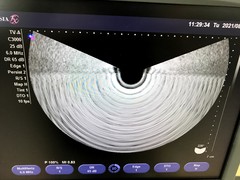 Ultrasound system｜SONOVISTA FX｜Mochida Siemens Medical Systems photo2