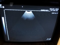 Ultrasound system｜SSA-325A｜Canon Medical Systems photo2