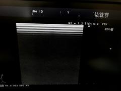Ultrasound system｜F37｜Hitachi photo2
