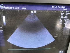 Ultrasound system｜LOGIQ S6 CRT｜GE Healthcare photo3
