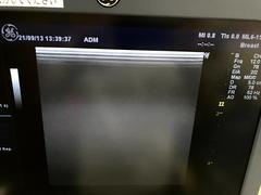 Ultrasound system(Color)｜LOGIQ P6｜GE Healthcare photo3