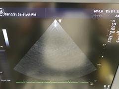 Ultrasound system(Color)｜LOGIQ P6｜GE Healthcare photo3