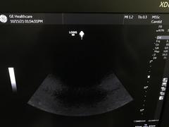超音波診断装置｜LOGIQ S8 XDclear2.0+｜GEヘルスケアの写真19枚目