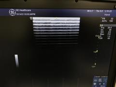 Ultrasound system(Color)｜LOGIQ e Premium Pro｜GE Healthcare photo15