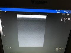 Ultrasound system(Color)｜UF-750XT｜Fukuda photo2