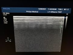 Ultrasound system｜iE33｜Philips photo22