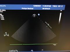 Ultrasound system｜iE33｜Philips photo17
