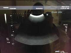 超音波診断装置（カラードプラ）｜SSA-680A XarioXG｜キヤノンメディカルシステムズの写真18枚目