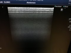 超音波診断装置（カラードプラ）｜Xario100 TUS-X100｜キヤノンメディカルシステムズの写真16枚目