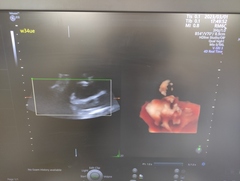 4D超音波診断装置（カラードプラ）｜Voluson E10｜GEヘルスケアの写真22枚目