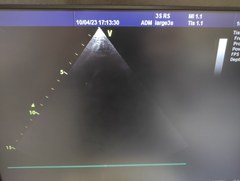 超音波診断装置（カラードプラ）｜Vivid S6｜GEヘルスケアの写真22枚目