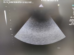 超音波診断装置｜ACUSON S2000 HELX Evolution｜持田シーメンスメディカルの写真22枚目