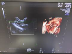 Ultrasound system(Color)｜Voluson E10｜GE Healthcare photo22