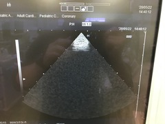 Ultrasound system(Color)｜HI VISION 900｜Hitachi Medical photo3