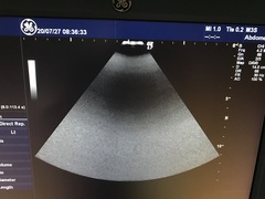 Ultrasound system(Color)｜LOGIQ 7｜GE Healthcare photo23
