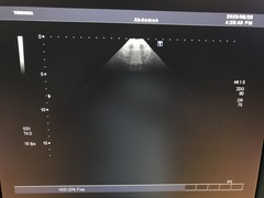 Ultrasound System(Color)｜SSA-790A Aplio XG｜Canon Medical Systems photo20