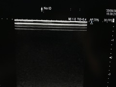 超音波診断装置｜ARIETTA S70｜日立製作所の写真19枚目