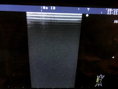Ultrasound system(Color)｜SSD-3500SV｜Aloka photo2